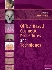 FRACTIONAL LASERS: GENERAL CONCEPTS