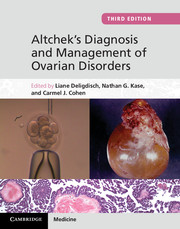 Early detection of ovarian cancer