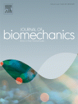 Biomechanical properties and histological structure of sinus of Valsalva aneurysms in relation to age and region