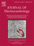 Time to reperfusion in acute myocardial infarction. It is time to reduce it