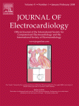 What is inside the electrocardiograph?