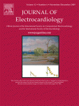Improvements in atrial fibrillation detection for real-time monitoring