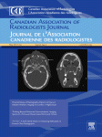 Assessing the Impact of Incidental Findings in a Lung Cancer Screening Study by Using Low-dose Computed Tomography