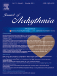 Topographic variability of the left atrium and pulmonary veins assessed by 3D-CT predicts the recurrence of atrial fibrillation after catheter ablation