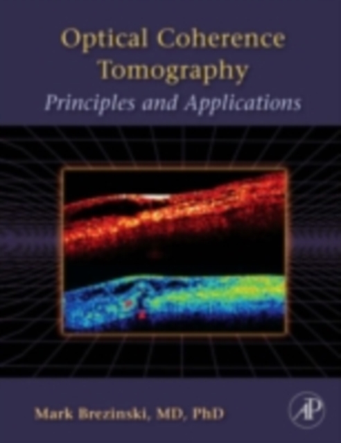 Optical coherence tomography : principles and applications