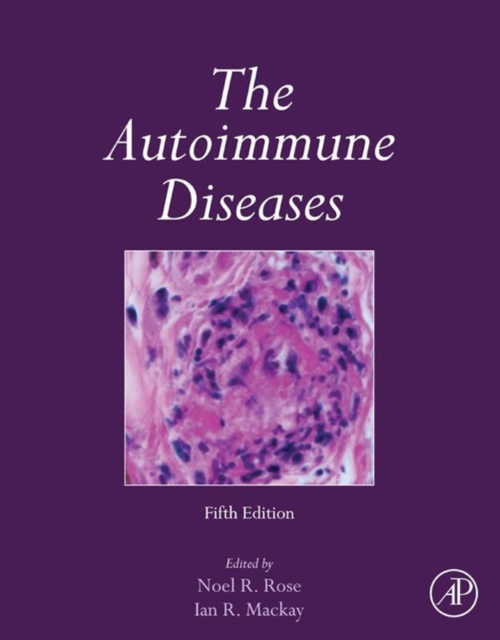 The autoimmune diseases