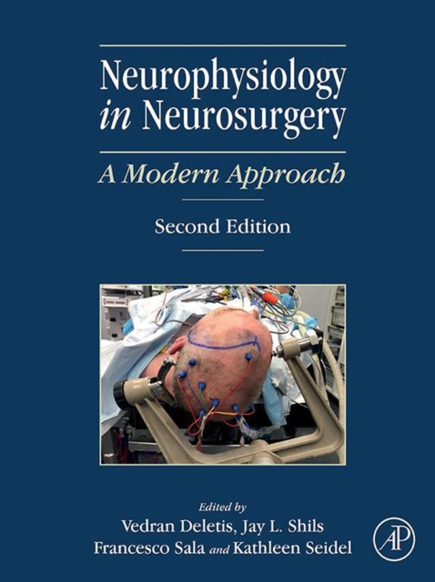 Neurophysiology in neurosurgery : a modern approach
