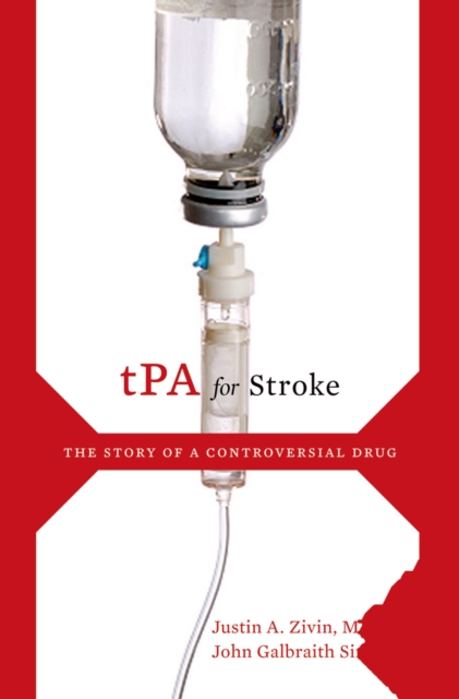 TPA for Stroke