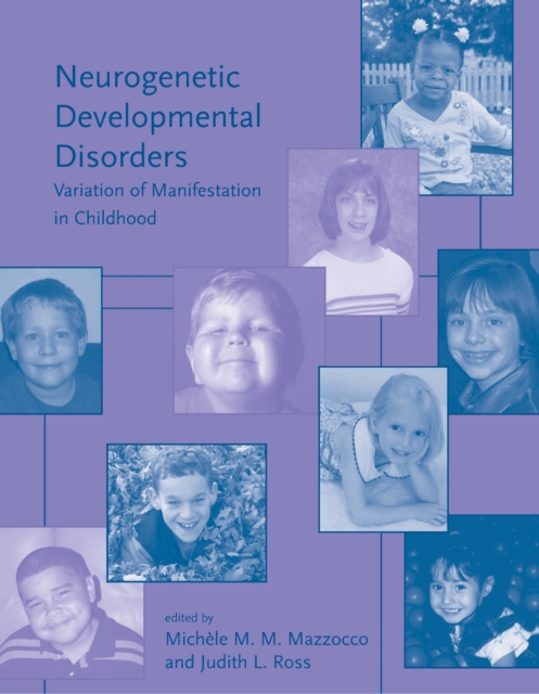 Neurogenetic developmental disorders : variation of manifestation in childhood