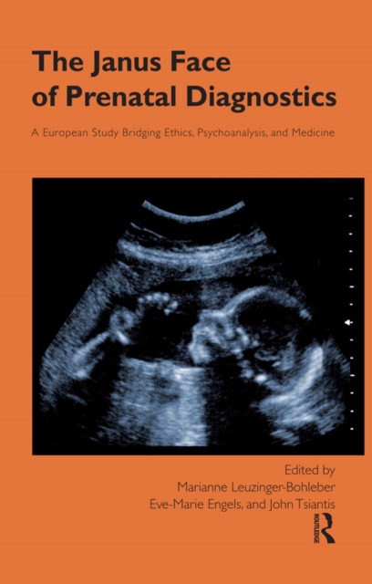 The janus face of prenatal diagnostics