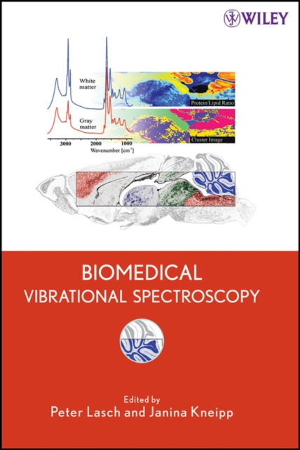 Biomedical vibrational spectroscopy
