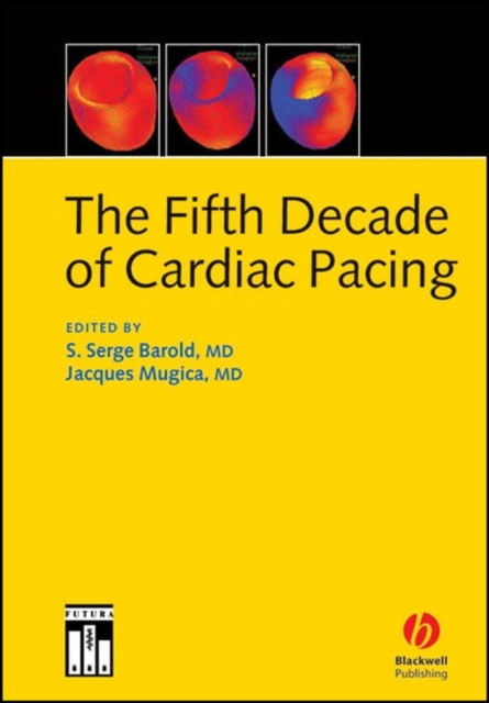 The Fifth Decade of Cardiac Pacing