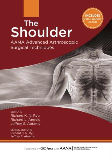 AANA advanced arthroscopic surgical techniques.: (The shoulder)