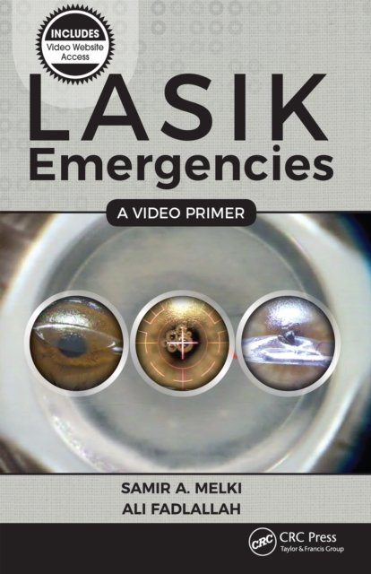 LASIK Emergencies