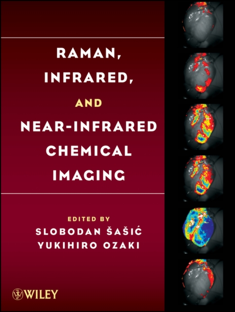 Raman, infrared, and near-infrared chemical imaging