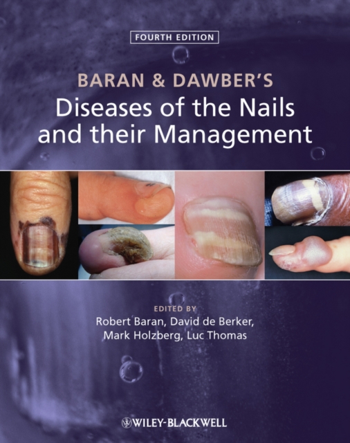 Baran & Dawber's diseases of the nails and their management