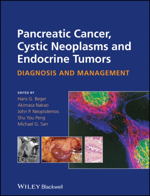 Pancreatic cancer, cystic neoplasms and endocrine tumors : diagnosis and management