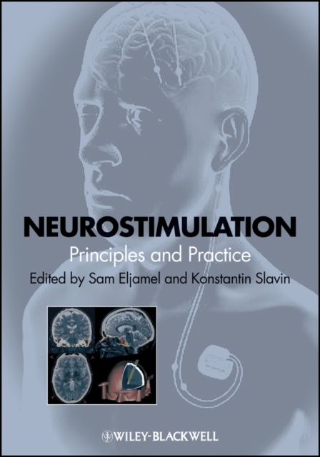 Neurostimulation : principles and practice
