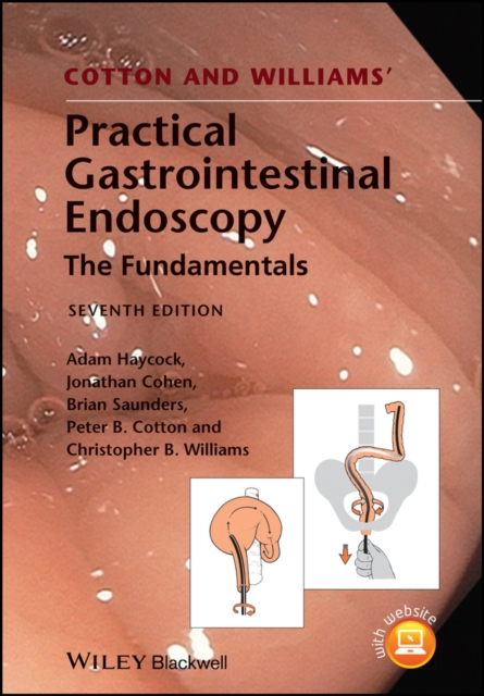 Cotton and Williams' practical gastrointestinal endoscopy