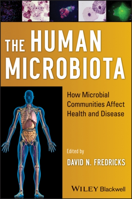 The human microbiota
