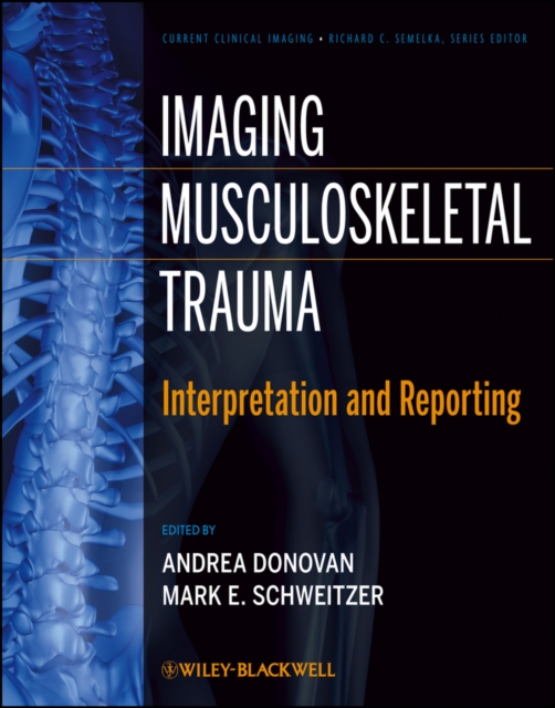 Imaging musculoskeletal trauma