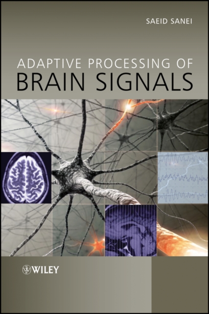 Adaptive processing of brain signals