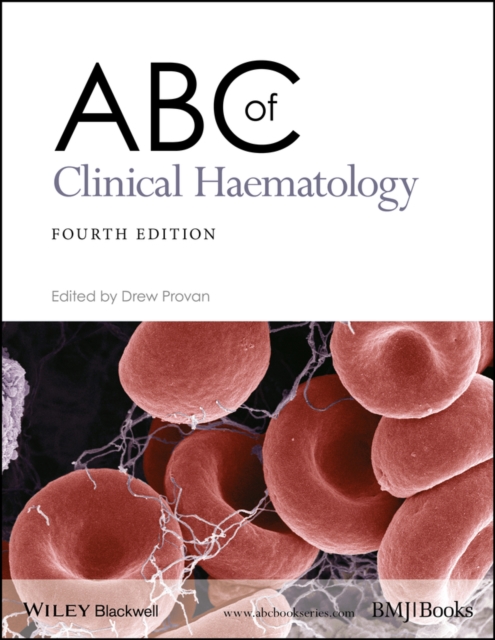 ABC of clinical haematology