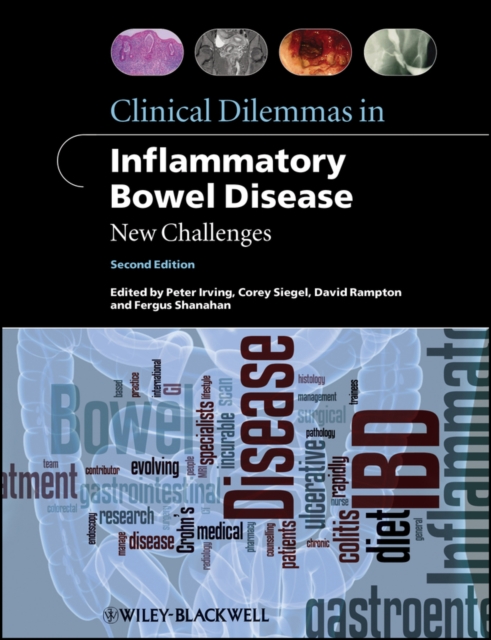 Clinical Dilemmas in Inflammatory Bowel Disease