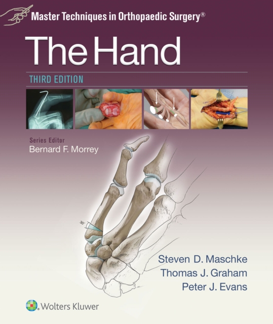 The hand
