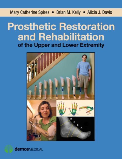 Prosthetic restoration and rehabilitation of the upper and lower extremity