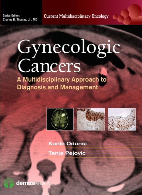 Gynecologic cancers