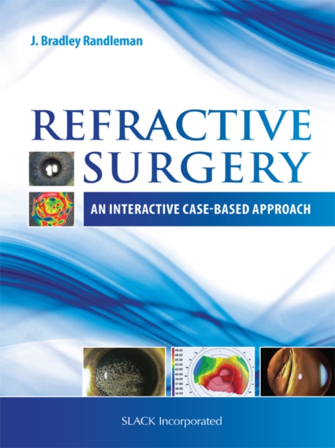 Refractive Surgery