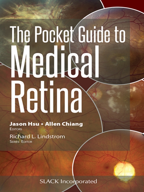 The Pocket Guide to Medical Retina
