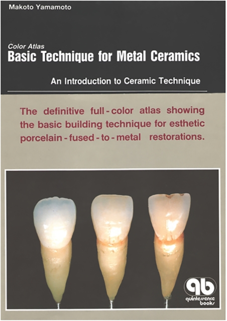Color Atlas Basic Technique for Metal Ceramics