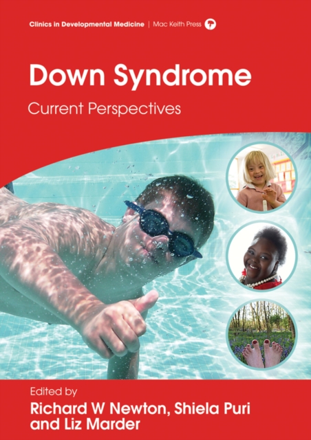 Down syndrome : current perspectives