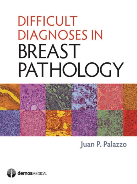 Difficult diagnoses in breast pathology