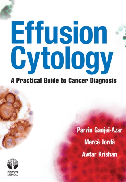 Effusion cytology