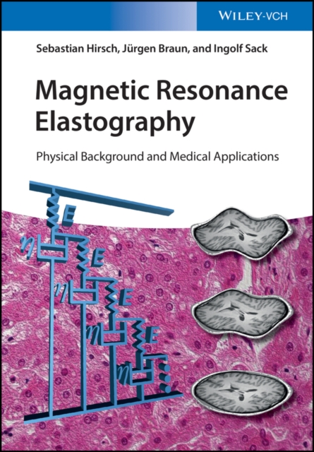 Magnetic Resonance Elastography