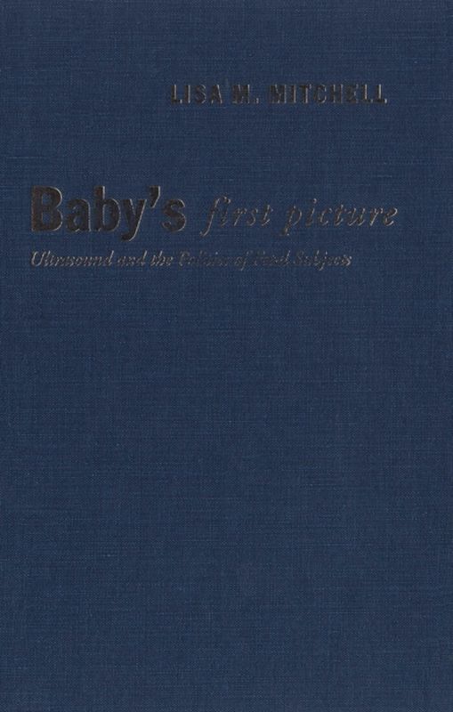 Baby's First Picture